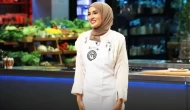 MasterChef Beyza’dan Çarpıcı İtiraf: "Yüzümdeki İzlere Alıştım"