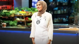 MasterChef Beyza’dan Çarpıcı İtiraf: "Yüzümdeki İzlere Alıştım"