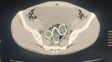 Uyuşturucuyu Cinsel Organlarında ve Midelerinde Gizleyen 3 Kişi Tutuklandı