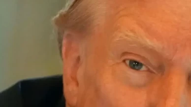 Donald Trump Bandajı Çıkardı! Nasıl Bu Kadar Hızlı İyileşti?